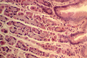 Gastric Gland Histology