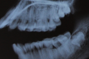 Dental students