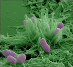 Scanning electron micrograph of enteropathogenic Escherichia coli infecting an epithelial cell