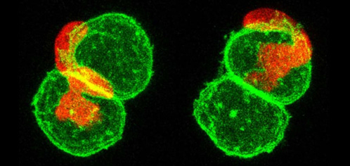 Leucocyte cancer cells