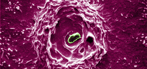 Electron microscope image of cell