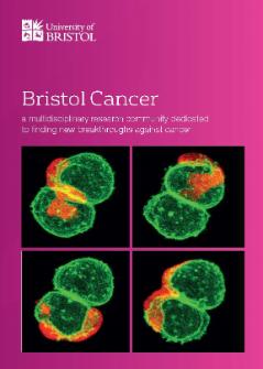 Cancer research at the University of Bristol