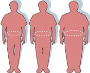 Illustration of obesity and waist circumference
