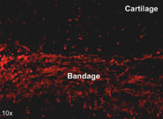 Labelled cells showing they have migrated into the cartilage