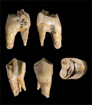 Teeth from Pego do Diabo, Portugal