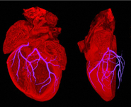 Heart showing position of coronary arteries