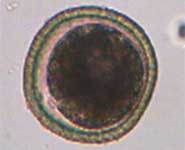 A Toxocara egg. Actual size approximately 0.06 mm