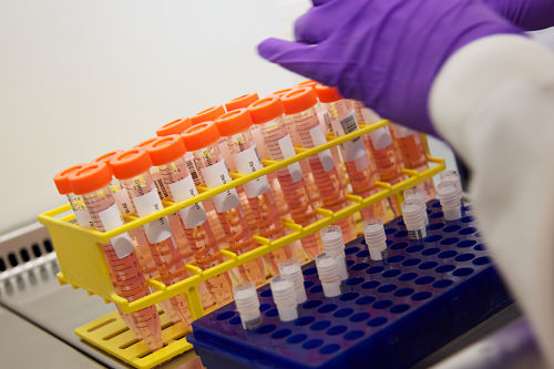 Biological samples being processed