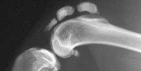 radiograph of joint