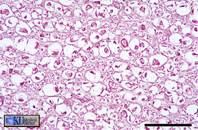 6. Nervous tissue