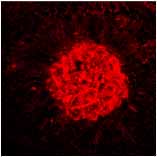 angiogenesis following laser