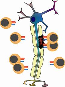 picture of nerve being attacked by T cells