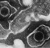 the Epstein-Barr virus
