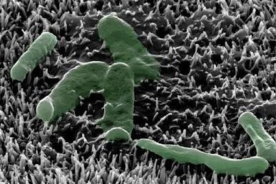 An upclose image of nanospikes.