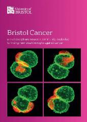 Cancer research at the University of Bristol