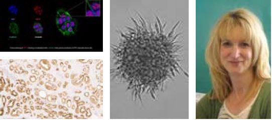 Cancer endocrinology and metabolism