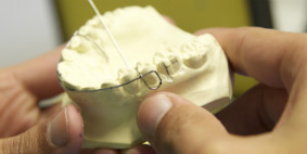 Hands holding a plaster model of jaw with wire bent