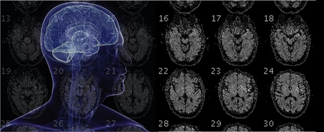 Composite image of a human and MRI scans