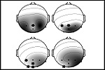 Image of EEG data, select to go to the PG Diploma in Applied Neuropsychology (Bristol-based) page