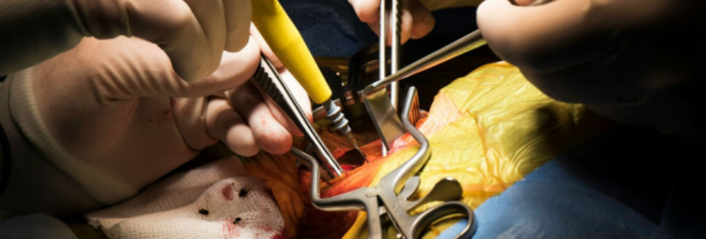 close up of surgery, hands in rubber gloves