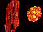 Live (left) and dead heart cells. When mitochondria don't produce enough ATP the rod-like cells die and 'round up'.