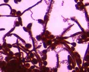 Yeast and hyphal forms of Candida albicans (purple spherical, ovoid and filament shapes) with communities of streptococcus bacteria attached to them, growing in harmony