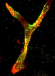 JAM-1 (green) on a small blood vessel (red)