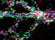 Distribution of SUMOylation enzymes (red) in a hippocampal neurone.