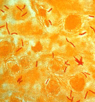 TB bacteria (red)