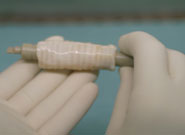 The transplanted trachea