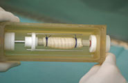 The scaffold trachea in the new bioreactor, prior to reseeding with stem cells
