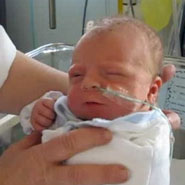 Riley Joyce, the first baby to receive the treatment