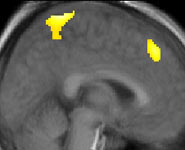 Our neural activity tends to be stimulated by our competitor’s errors (as in the example shown here) rather than their successes.