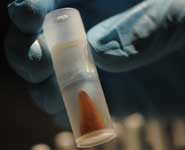 One of Eadgyth’s teeth surrounded by synthetic material for preparation of a thin section for age determination
