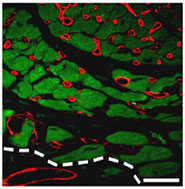 Following a heart attack, new vessels formed around the infarct to help re-establish the blood flow to the damaged heart: cardiac cells stained green; vessel stained red; demarcation of infarct by dotted line