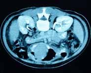A CAT scan image of human internal organs