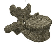 The computerised tomography (CT) scans lead to detailed 3-dimensional computer models of vertebra