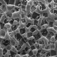 A scanning electron microscope photograph of the surface of a macroporous elastomer, a type of polymer. Full control of the elastomer pore size allows the release of a wide range of therapeutic agents ranging from pharmaceutical chemicals to therapeutic stem cells.