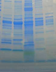 A gel produced by the students that compares muscle proteins from different fish (from left to right, cod, pollock, squid, salmon and tuna. The different banding patterns are a measure of evolutionary relatedness.