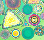 The image shows part of a group of diatoms viewed with a light microscope using Jamin-Lebedeff Polarising Interference. 160:1 on 35 mm slide.