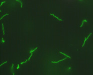 Oral bacteria called Treponema denticola