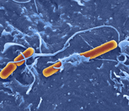 Shigella flexneri invading embryonic stem cell