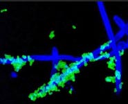 Streptococcus bacteria (green) tightly associated with hyphal filaments of Candida albicans (blue)