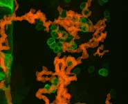 Tracks/footprints of white blood cells as they find early cancer cells (green) in the zebrafish larvae
