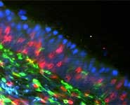CD4 T-lymphocytes (green) and CD8 T-lymphocytes (red) in the respiratory mucosa of pigs (structural components including nuclei in blue)
