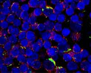 The cover image of Circulation Research shows bone marrow CD34 positive cells (green) expressing intranuclear FOXO3a