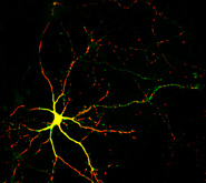 Drp1 colocalisation with mitochondria in a neurone