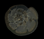 Synchrotron X-ray Tomography Microscopy (SXRTM) image of benthic foraminifera, unicellular, deep-sea floor dwelling calcifiers, which lived during the Paleocene-Eocene Thermal Maximum (~55 Ma), a past analog for future global warming related to high CO2 levels, and related ocean acidification. Their calcification increased unexpectedly during ocean acidification. Images generated using AvizoTM.