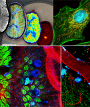 Examples of in-vivo imaging that will be possible with the new equipment.