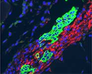 Human neural stem cells (hNSCs) promote neovascularization in ischemic mouse model adductor muscle. High-power view shows hNSCs labelled with human specific nestin (green) surrounded by host cells labelled with α-smooth muscle actin (red) counterstained with Hoechst (blue).